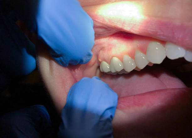 Best Mobile Emergency Dentist in Afton, WY